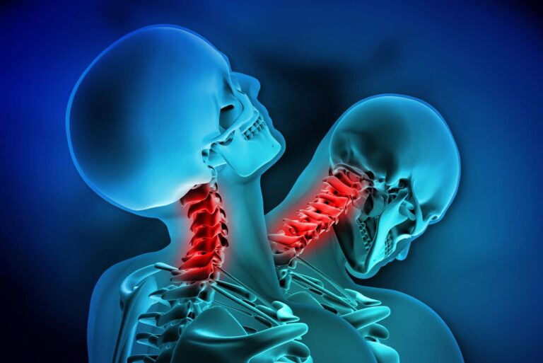 3D illustration of two human skeletons, with highlighted cervical spine areas in red indicating neck pain or injury, such as whiplash, on a blue background.